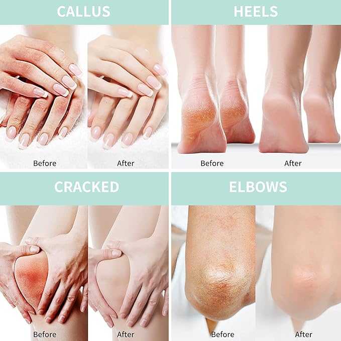 Grocerism – The Fastest Way to Get Healthier Feet