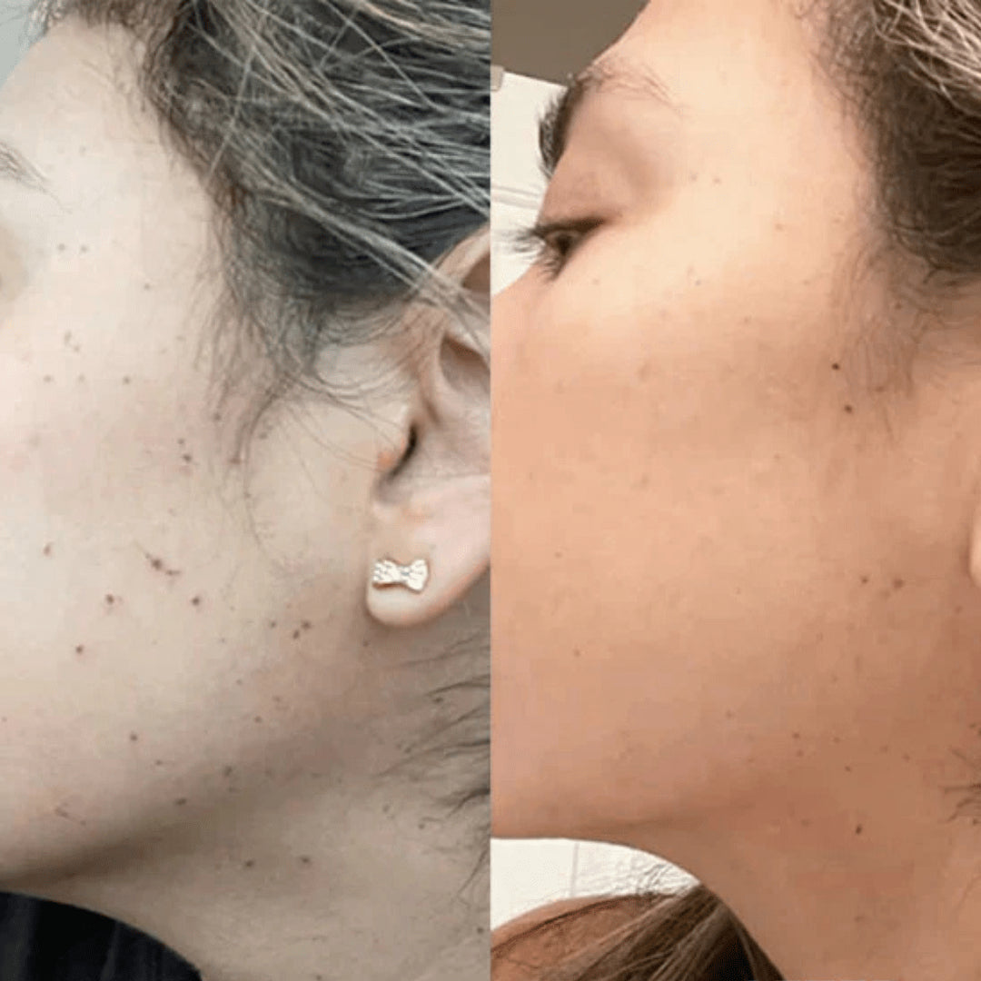 Swisscure™ – Your Path to Clearer, Blemish-Free Skin