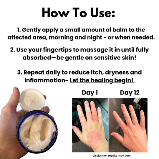 Soothing Eczema Relief Cream