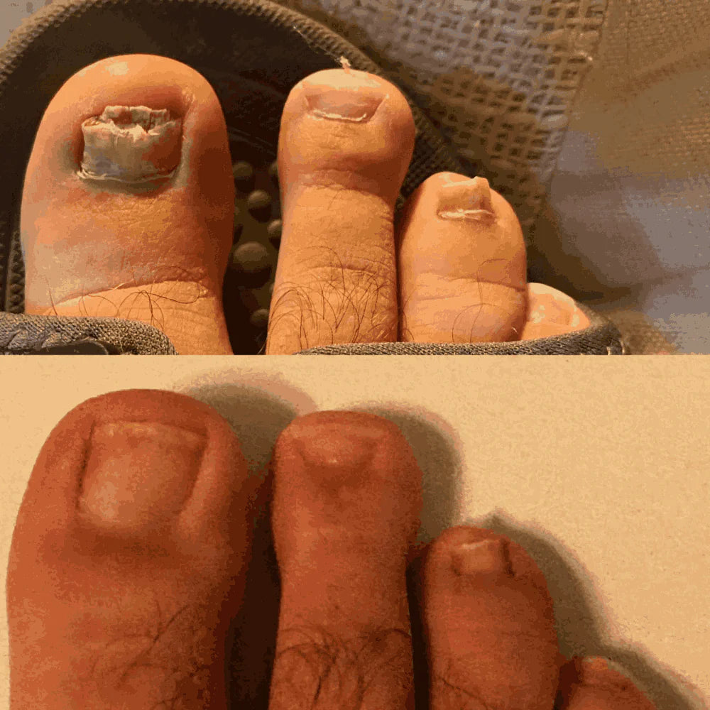 SwissCure™ - Votre chemin vers des ongles plus sains